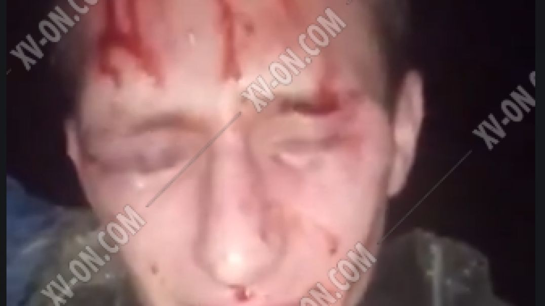 Chopped off a guy's finger for stealing drugs⭐ Beating up a young guy